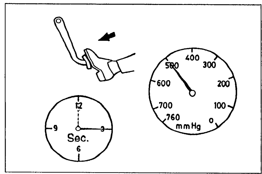Hand pressing brake pedal with downward arrow, paired with a vacuum gauge (mmHg) and a stopwatch displaying seconds — illustrates the loaded-condition vacuum loss test.